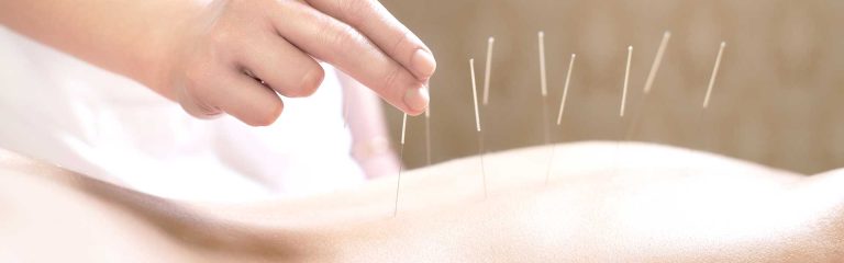 Read more about the article ฝังเข็ม Acupuncture ศาสตร์การรักษา ฟื้นฟูสุขภาพ ในแพทย์แผนจีน