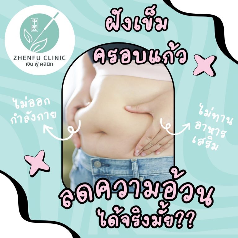 Read more about the article ฝังเข็มลดความอ้วน ได้จริงหรือ?