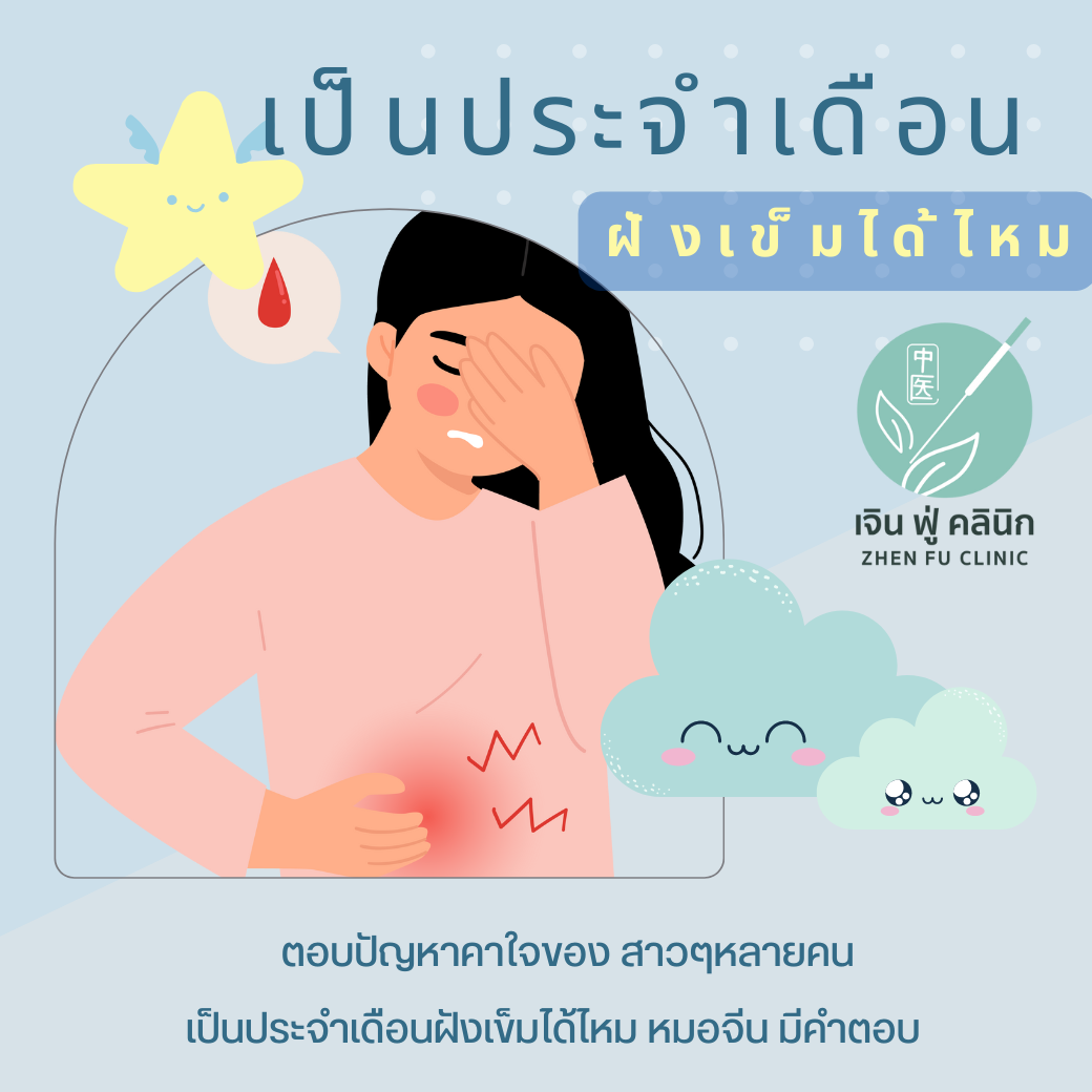 You are currently viewing ฝังเข็มในช่วงมีประจำเดือน: เรื่องที่ผู้หญิงควรรู้