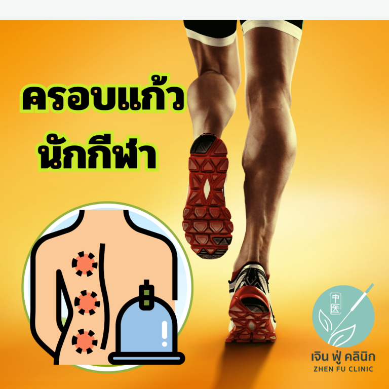 Read more about the article ครอบแก้วสำหรับนักกีฬา ช่วยอะไรได้บ้าง?