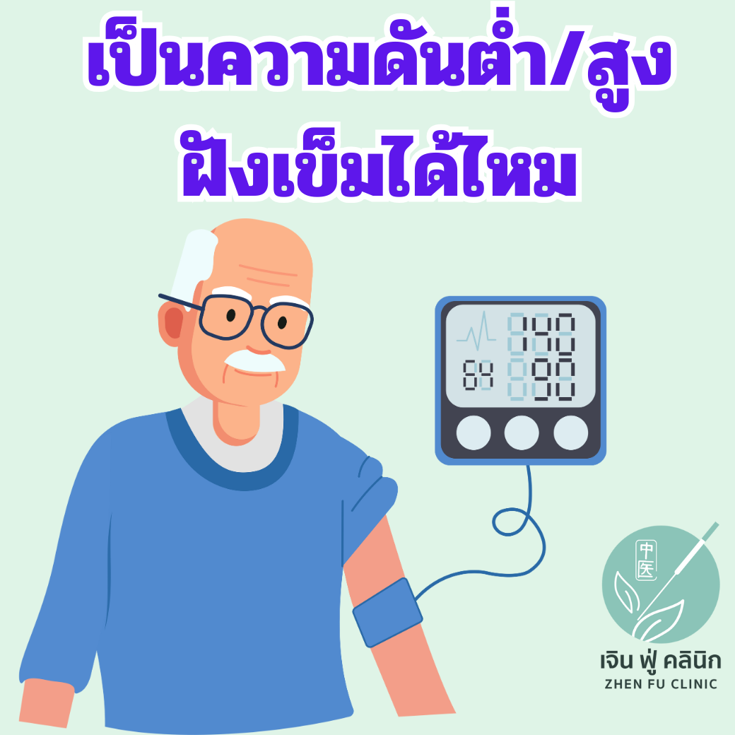 You are currently viewing เป็นความดัน ฝังเข็มได้ไหม?