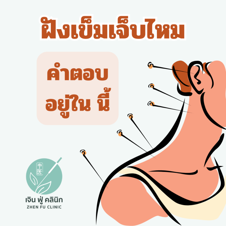 Read more about the article ฝังเข็มเจ็บไหม?